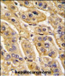 HIBCH Antibody (Center)